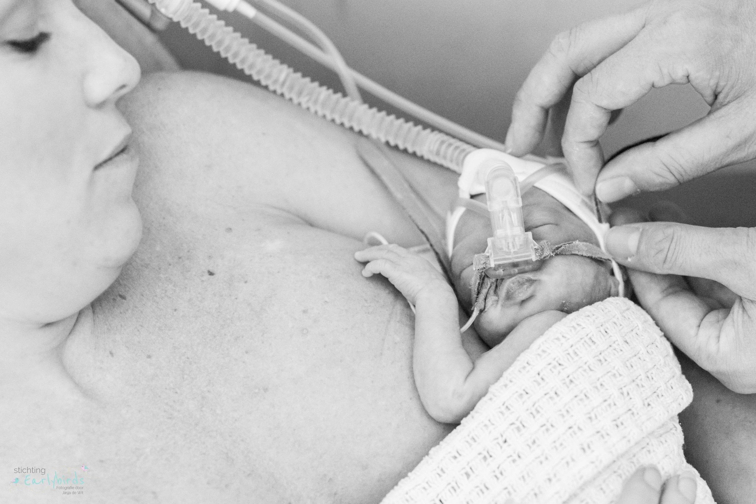 Baby buidelt bij moeder en vader past de CPAP aan